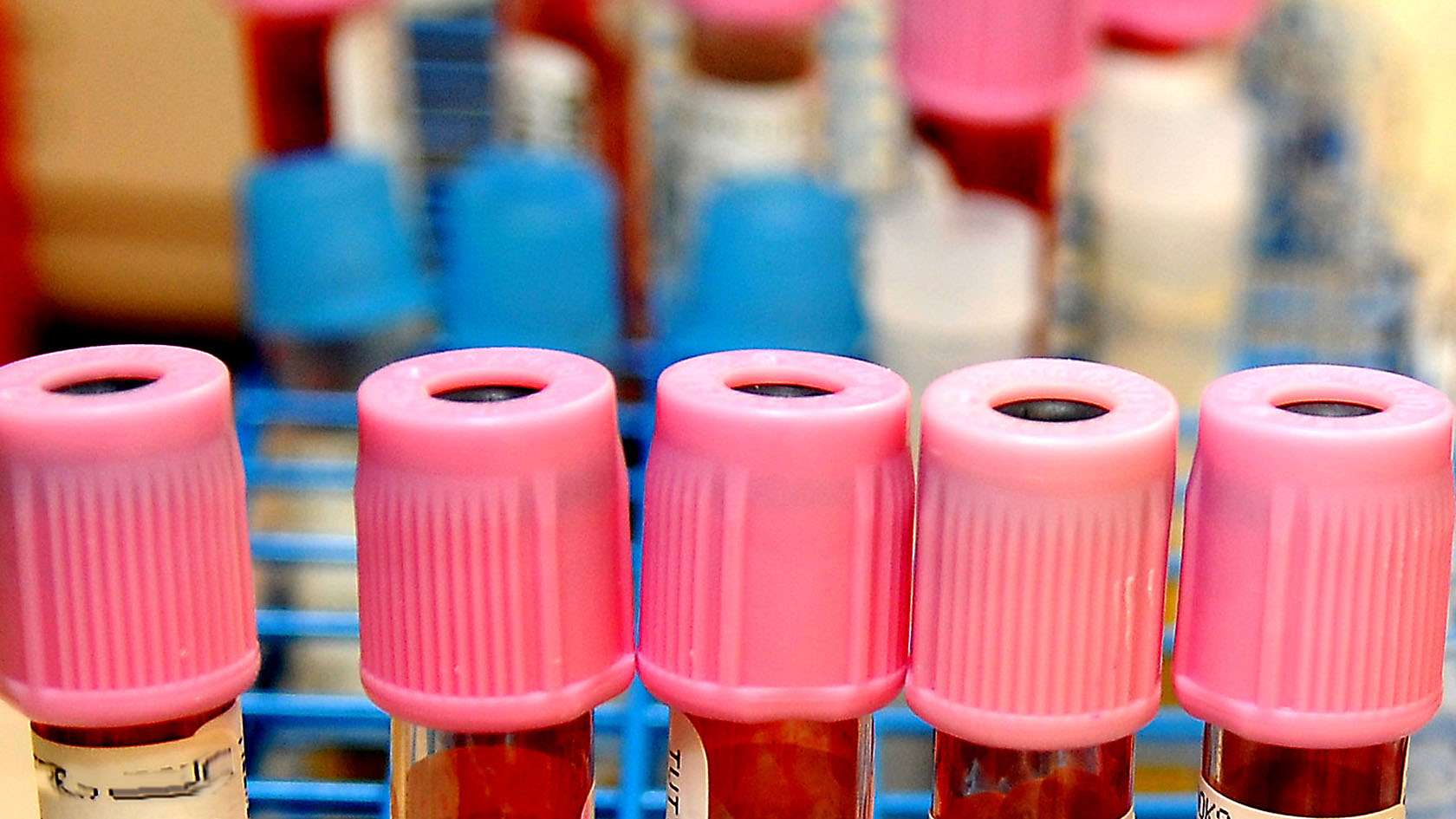 Vials of blood